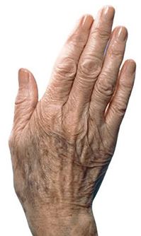 Hand wrinkles
